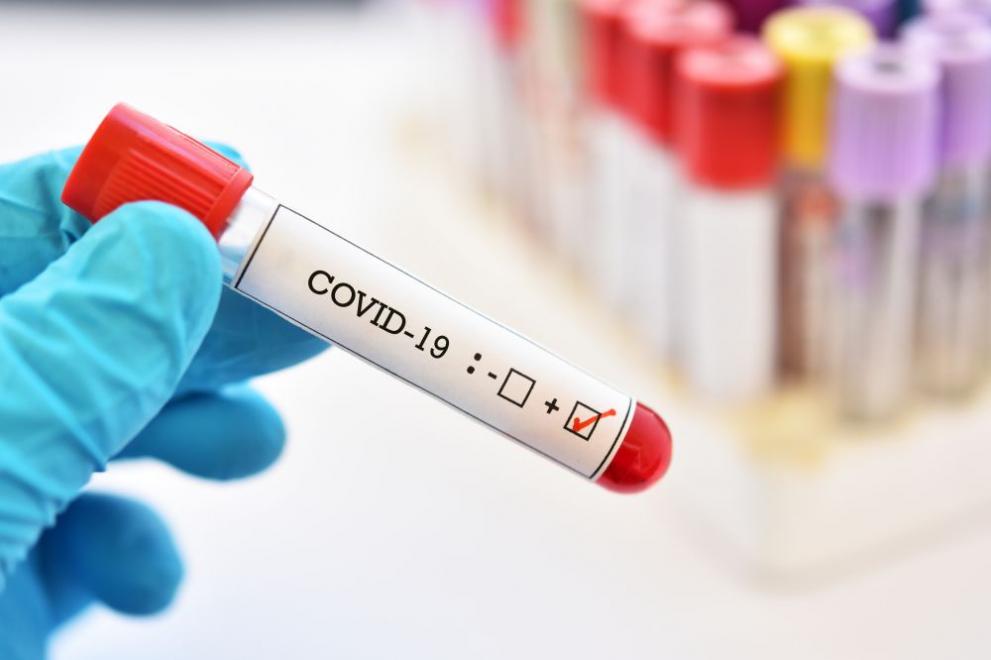 Минздрав разрешил врачам устанавливать диагноз «инфекция COVID-19» без ПЦР-тестирования